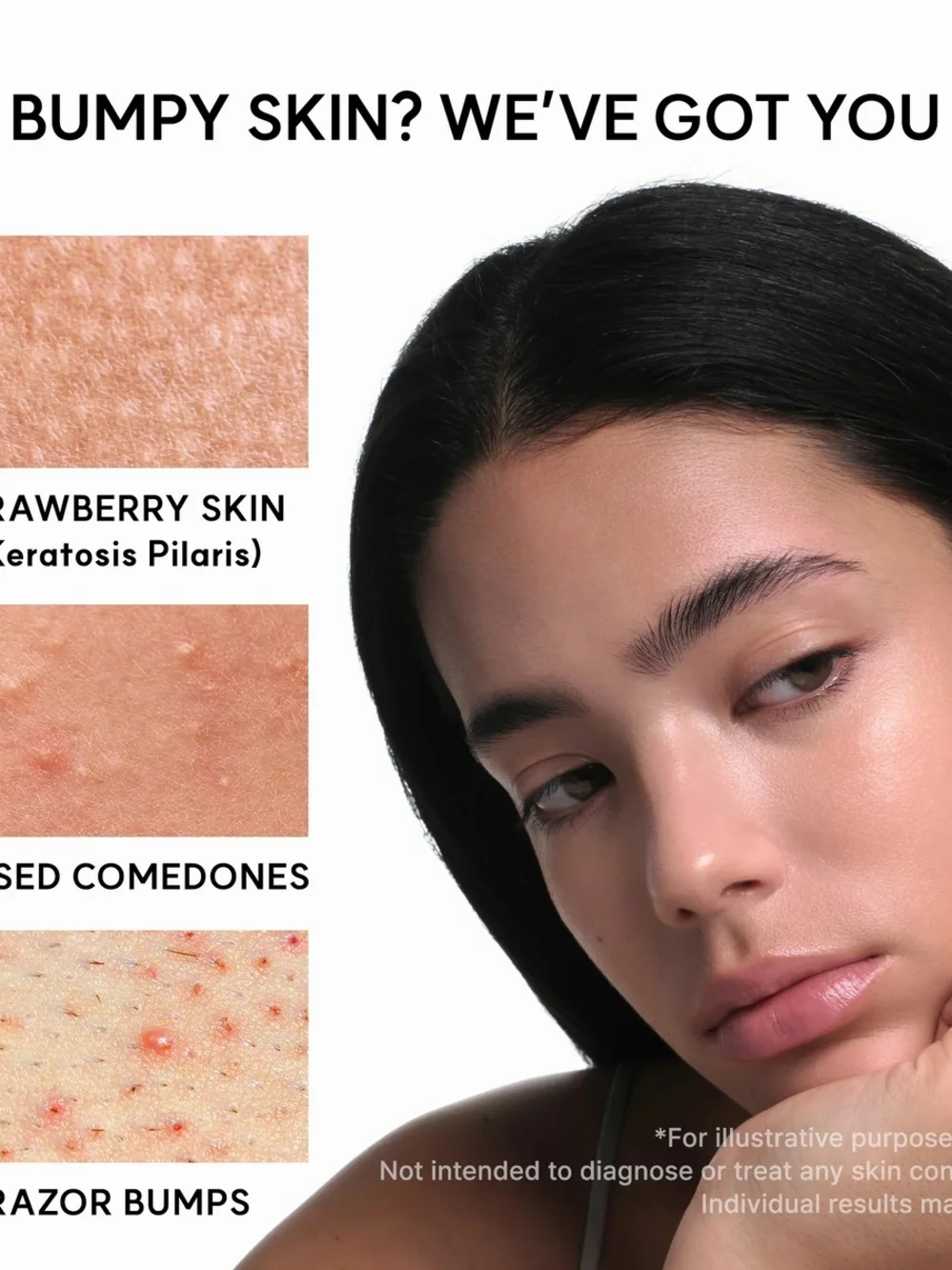 Arencia - Eraser Shot Glycolic Acid Booster